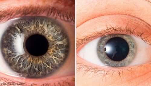 göz bebekleri geniş dar