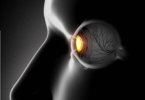 Şaşı Gözler: Belirtileri ve Tedavileri