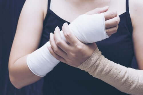 bandajlı kolu ile alçılı elini tutan kadın