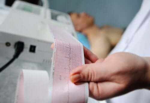 Elektrokardiyogram veya EKG: Yorumlamak için Adımlar