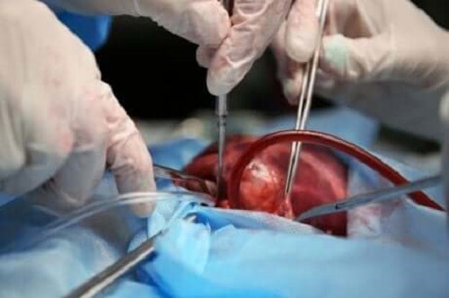 Kalp ameliyatı yapan doktorlar.