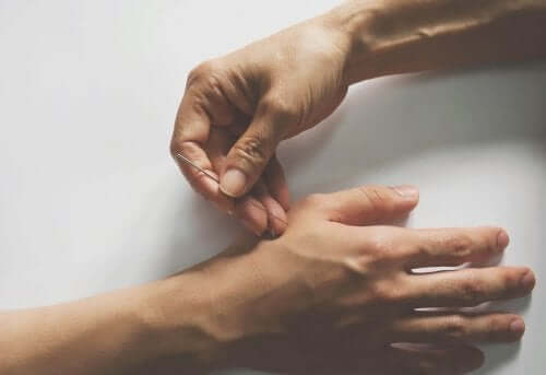 akupunktur iğne el