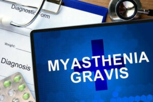 Myasthenia Gravis İle İlgili Bilmeniz Gereken Her Şey