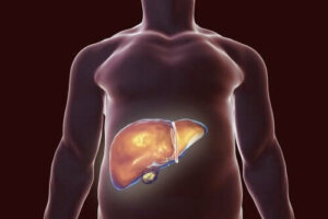 Safra Kesesi İçin Yemeniz ve Yememeniz Gerekenler