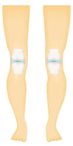 Sinovyal Eklem: Özellikleri ve Türleri