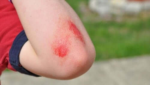 kesik ve sıyrık tedavisi