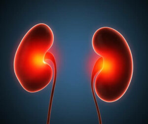 Renal Apseler ve Tedavileri