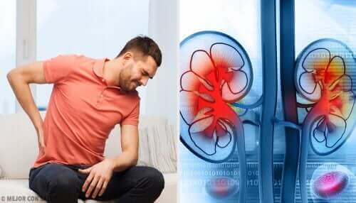 renal apse ağrısı çeken adam