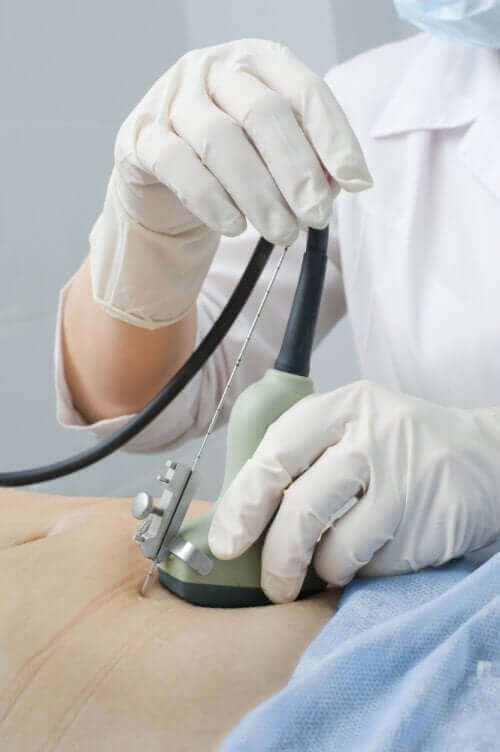 Bir kadına ultrason yapan bir doktor.