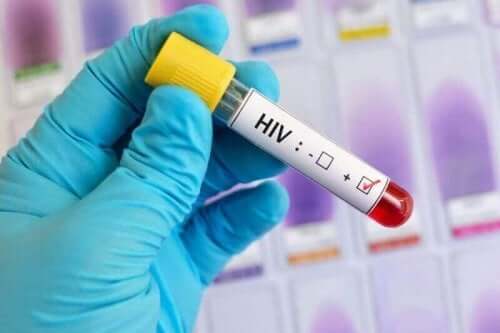 laboratuarda AIDS testi