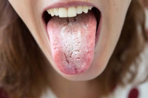 Dili beyaz olan insan ve dişleri