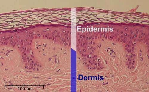 Derinin dermiş ve epidermis tabakalarını gösteren bir illüstrasyon.