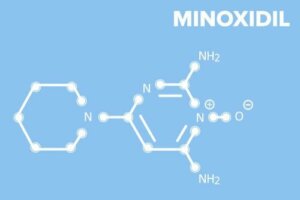 Minoksidil: Alopesi ve Saç Dökülmesi İçin Bir Tedavi
