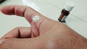 Salisilik Asit Nedir?