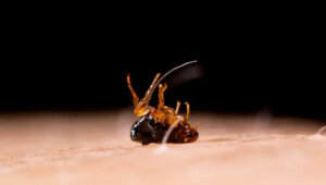 Tungiyaz: Semptomları ve Tedavisi