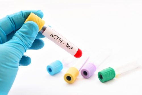 ACTH testi için doldurulmuş tüp