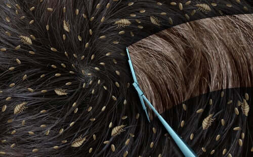 sirke nedir nasıl yayılır