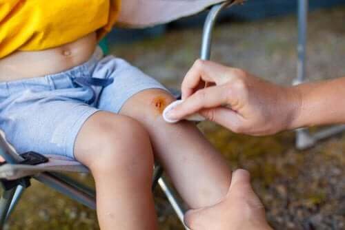 çocuk bacağı yara temizleme 