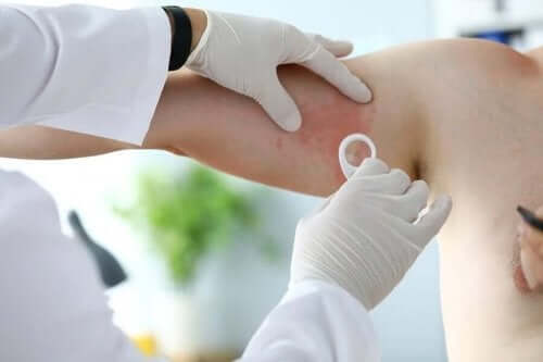 kol büyüteç dermatolog kızarıklık