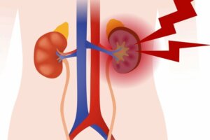 Vaskülit Nedir? Hangi Türleri Bulunur?