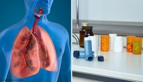 inhalerlar