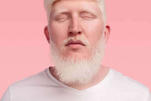 albinizm adam beyaz sakal 