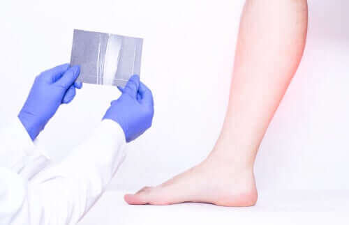 bacak ağrısı için doktora giden kadın