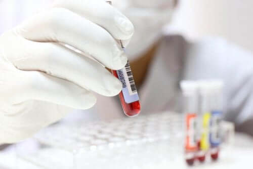 Kan testi yapmak için kan almış bir sağlık personeli.