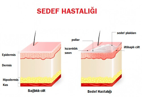 deri tabakaları