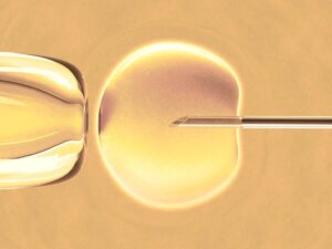 İn Vitro Fertilizasyon Nedir?