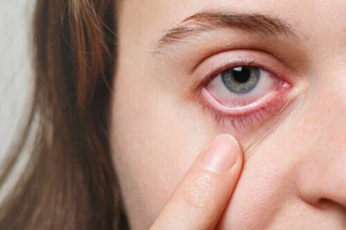 Göz Enfeksiyonları İçin 5 Etkili Çözüm