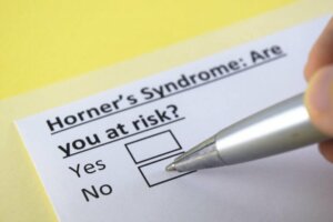 Horner Sendromu Nedir?