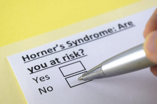 Horner Sendromu Nedir?