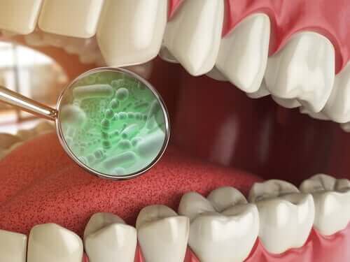 Ağzınızdaki Bakteri Türleri Nelerdir?
