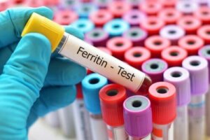 Yüksek Ferritin Nasıl Azaltılır