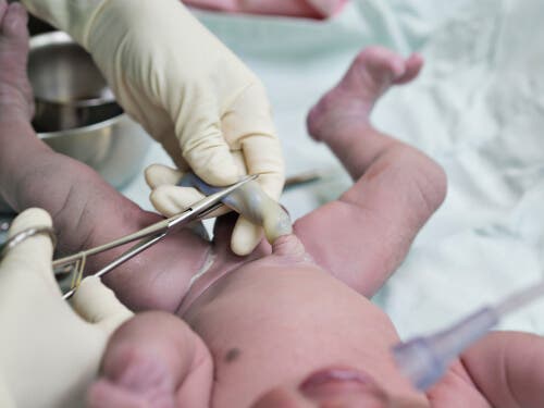 Yeni doğan bir bebeğin göbek bağını kesen bir doktor.