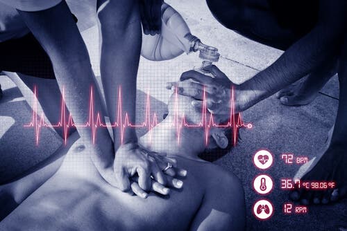 Kardiyopulmoner arrest yaşayan bir kişi.