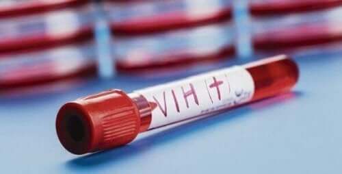 HIV pozitif kan örneği