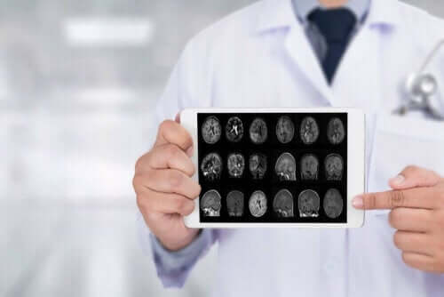 Beyin görüntüleri gösteren bir doktor.