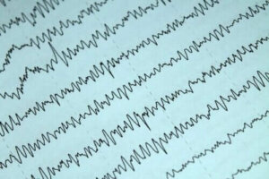 Emzirme Döneminde Epilepsi Nasıl İdare Edilir