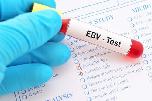 EBV kan testi