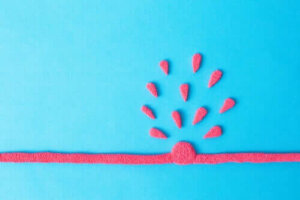 Abdominal Aort Anevrizması: Semptomları ve Tedavisi