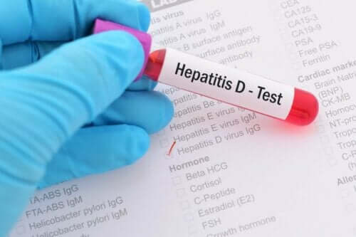 hepatit d testi