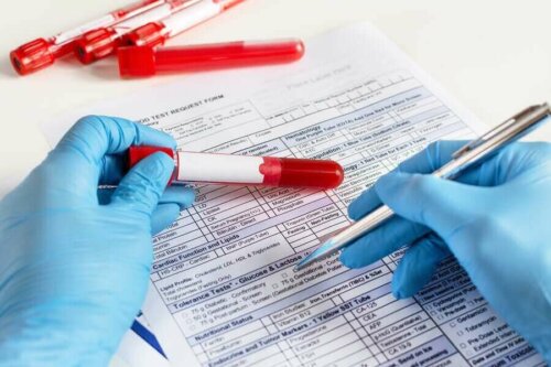 Kan testlerini analiz eden bir doktor.