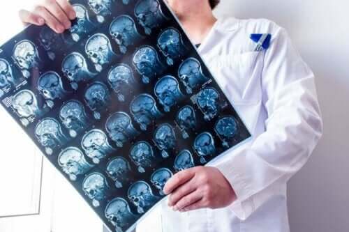 röntgen beyin doktor 