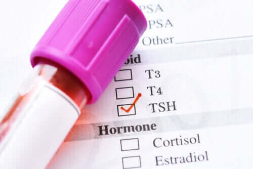 Tiroid Uyarıcı Hormon Düşüklüğünün Nedenleri