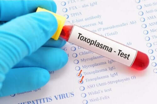 toksoplazma testi