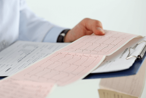 Kalp ritim bozukluğu ekg