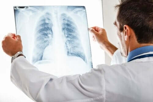 Akciğer filmini inceleyen doktor