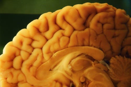 Üzerinde otopsi yapılmakta olan bir beyin.